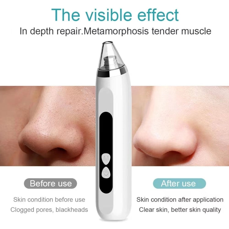 Blackhead Remover Vacuum Pore Cleaner Facial Deep Cleaning Beauty Tools